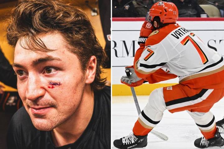 Ducks' Frank Vatrano bloodied after getting hit in face by puck