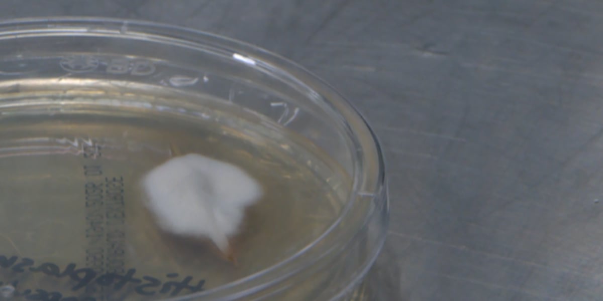 Nashville boy living with rare complication from histoplasmosis, fungal infection rising in Middle Tennessee