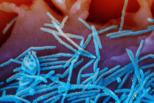 Winter virus season so far is not too bad, but doctors worry about suffering to come