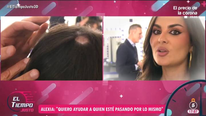 Alexia Rivas habla sobre su alopecia areata: "Cuando lo vi me fui al baño a vomitar"