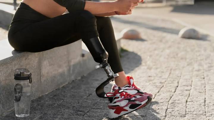 Actriz enfrenta amputación de su segunda pierna a los 29 años y comparte su proceso