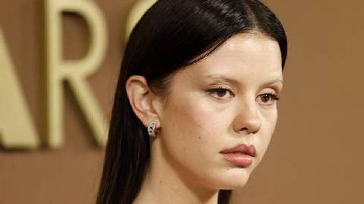 'Chicas zombies': la peligrosa tendencia de belleza "enferma" que sacude Hollywood