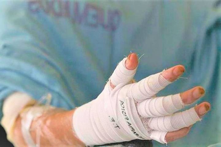 Un menor de edad, primer lesionado por pólvora en Nariño en esta Navidad