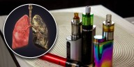 Vapeadores: los artefactos que deterioran el cuerpo hasta causar daños irreversibles