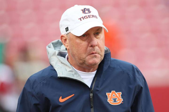 Battling Cancer, Hugh Freeze Gives Major Surgery Update a Month After Being Fired Hugh Freeze is pain-free and ready to coach again after recent surgery. The former Auburn coach gave a major health up