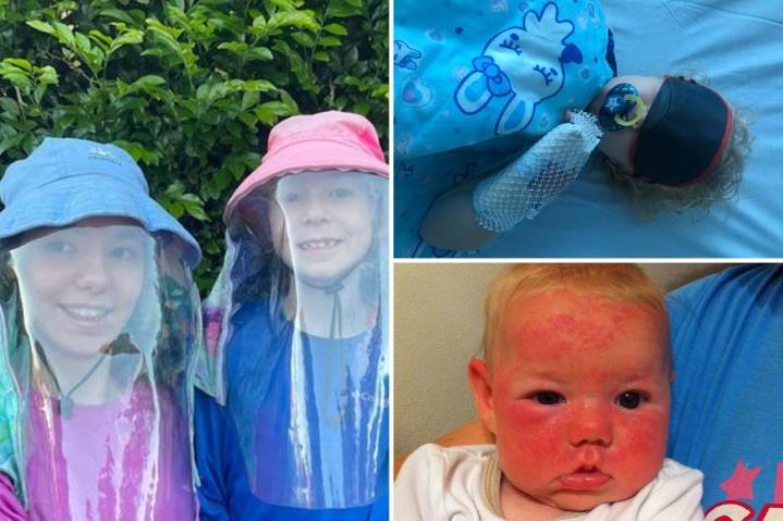 Sisters, 12, 7, face life-threatening consequences if exposed to sun
