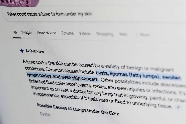 What is that rash? Doctors recommend people put some thought into asking Dr. Google for medical help