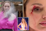 New Zealand reporter hit by flying bird, leaving her bloodied