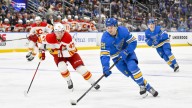 Blues lose one forward to surgery, another to ‘scalding burns’