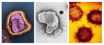 Tres virus respiratorios circulan en Venezuela