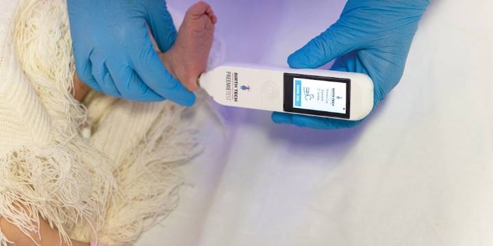 Así funciona el dispositivo brasileño con IA que revela la edad de los bebés prematuros y es apoyado por Bill Gates