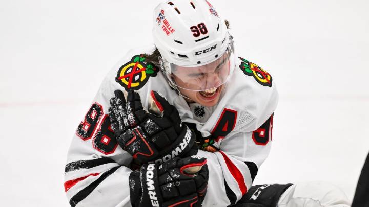 Blackhawks' Bedard hurt on last-second faceoff, out Saturday