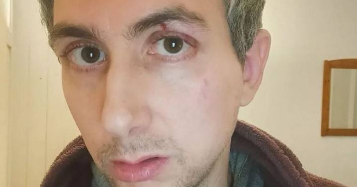 Man 'beaten' and told 'go home' by gang of youths in horrifying Edinburgh street attack