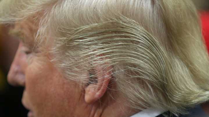 Finasteride Is The Hair Loss Drug Donald Trump Used And It Has Some Serious Drawbacks
