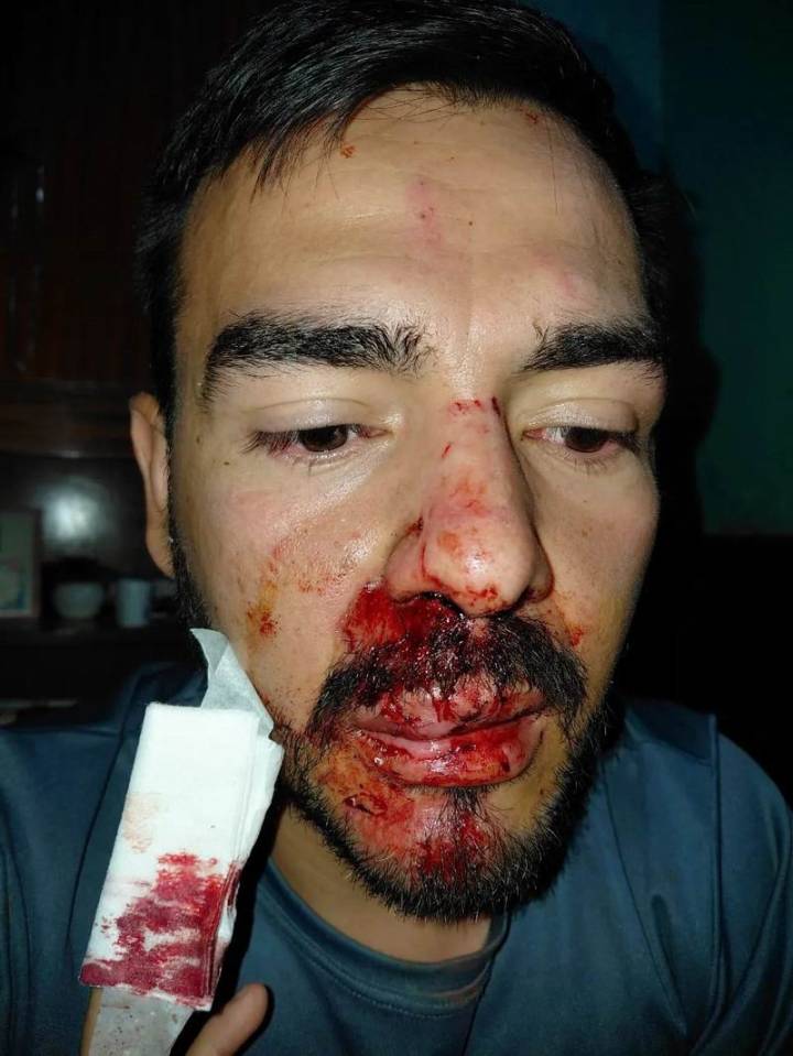 La violencia llegó al mundo del hockey