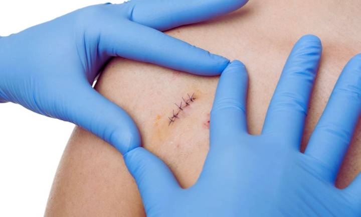 Oxytocin Plus Positive Partner Interaction Improves Stress Response and Wound Healing: JAMA