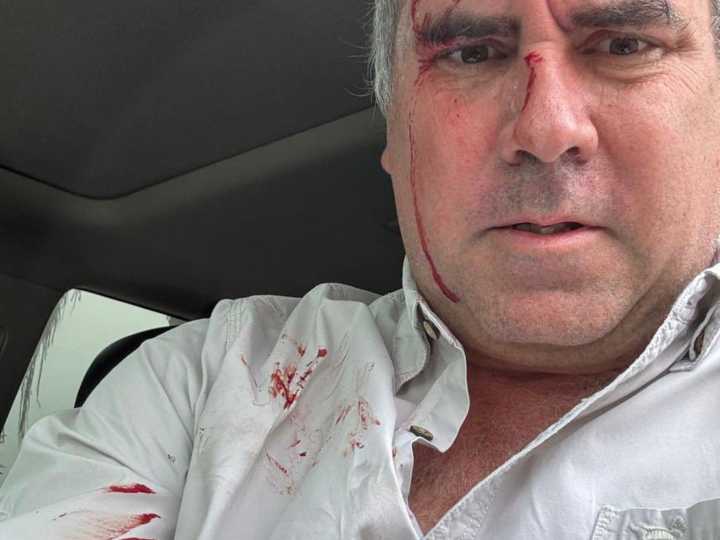 Perú: atacaron a balazos al candidato a presidente Rafael Belaúnde