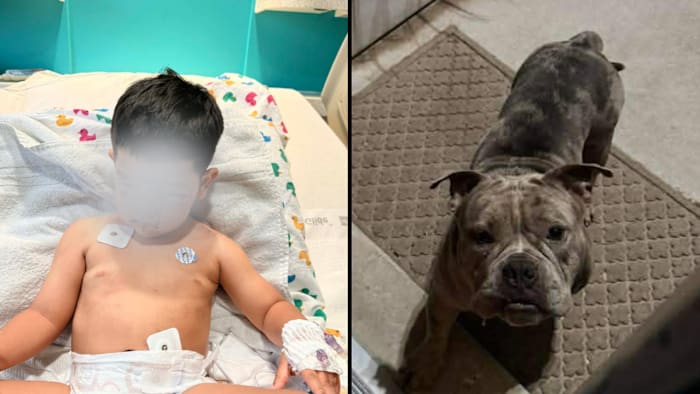 Child mauled by neighbor’s dog after barging through family’s front door in NE Harris County