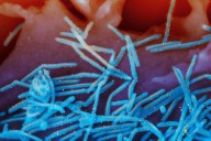 Winter virus season so far is not too bad, but doctors worry about suffering to come