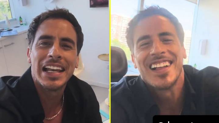 "Para que queden así de bellos como yo": Camilo Huerta mostró el novedoso tratamiento estético que se realizó