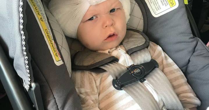 Babies as young as 7 months now have access to ‘transformative’ cochlear implants