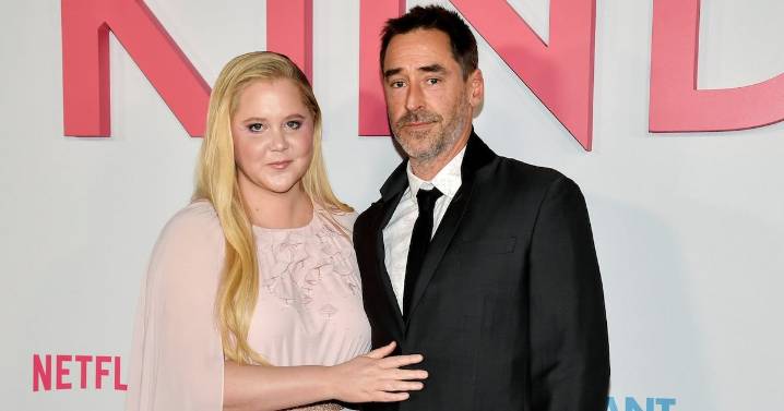 Amy Schumer and husband have decided to end their marriage