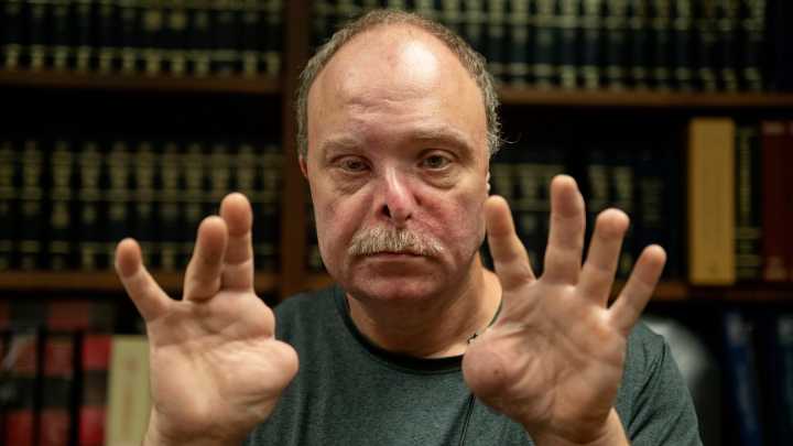 Man dismisses lawsuit against landlord for dog attack in Green