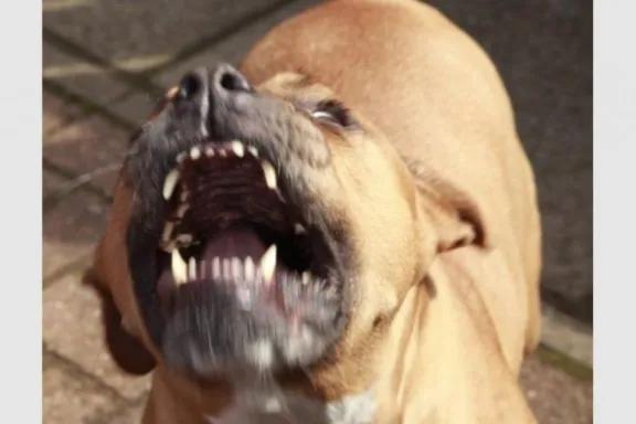 Córdoba: un nene de 9 años fue atacado por tres pitbull y quedó internado con graves heridas