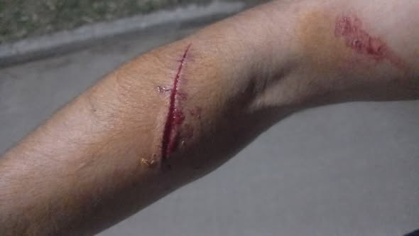 VIDEO | Un empleado de recolección se cortó el brazo con vidrios que tiraron en la basura