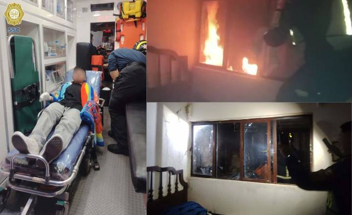 Le explota boiler a jovencito en La Magdalena Contreras