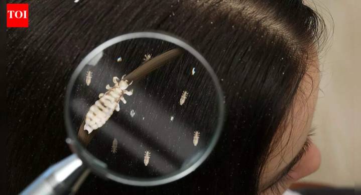 Why lice exist and where they actually came from