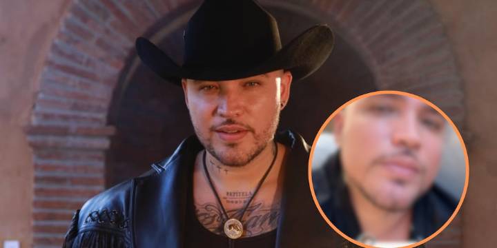 Jessi Uribe preocupa a seguidores: reveló problemas de salud con su piel y pidió consejos