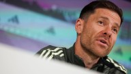 Xabi Alonso: "El equipo en general ha perdido un poco de calidad de juego"