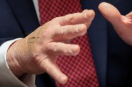 Critics doubt White House defense of Trump bandages: 'Is he shaking hands with chainsaws?'