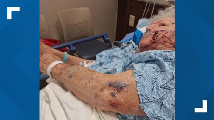 77-year-old woman fights for her life after intruder attacks her at home in Fort Worth