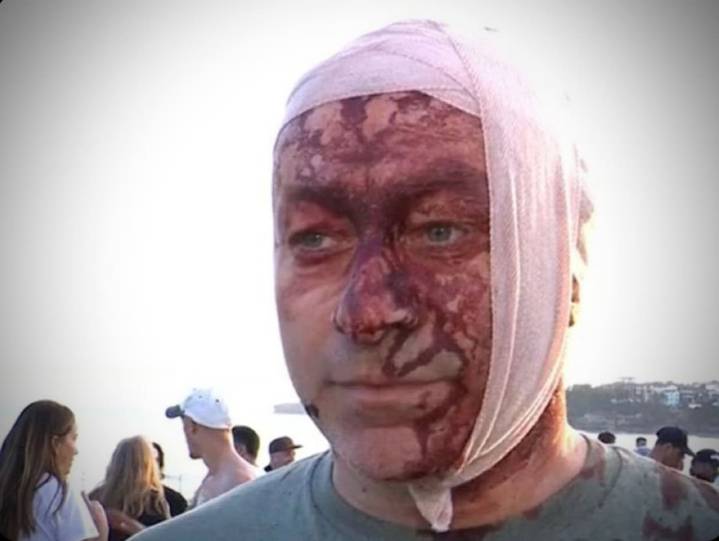 "Nunca pensé que vería esto aquí". Una de las víctimas del atentado en Australia también sobrevivió al ataque de Hamas el 7 de octubre