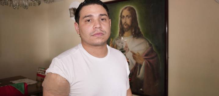 “Me puso la pistola en el cuello”: Rey Vallenato aficionado narró intento de atraco en el que resultó herido