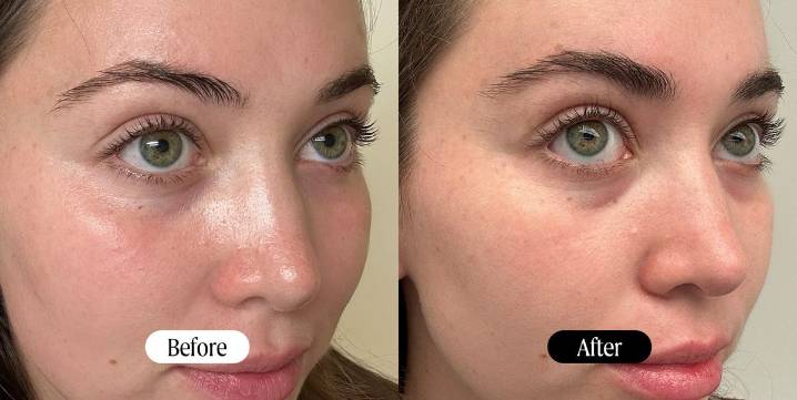 10 Best Eyelash Serums, Tested and Reviewed by Beauty Editors