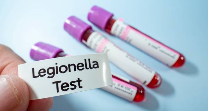 Reportan 14 casos de enfermedad del legionario en Florida: todos relacionados con un gimnasio