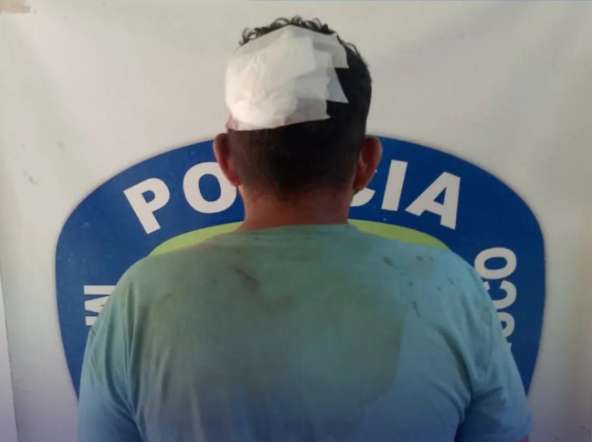 Detenido por cometer actos lascivos contra su hija