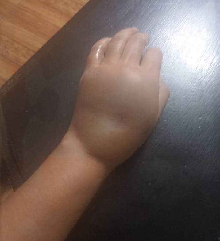 Denuncian a Cruz Roja en Coesprisson