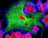 Romidepsin Identified as Candidate for Treating Relapsed Neuroblastoma