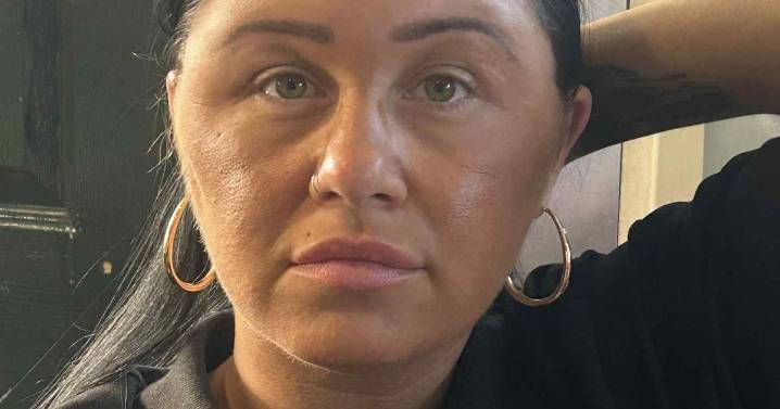 'Allergic reaction left me looking like I'd been in the ring with Mike Tyson'
