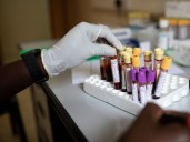 New HIV prevention guidelines say doctors should not 'gatekeep' meds