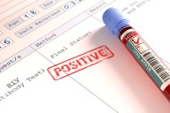 Senado aprueba en último debate ley que fortalece la atención del VIH, ITS y hepatitis en Colombia