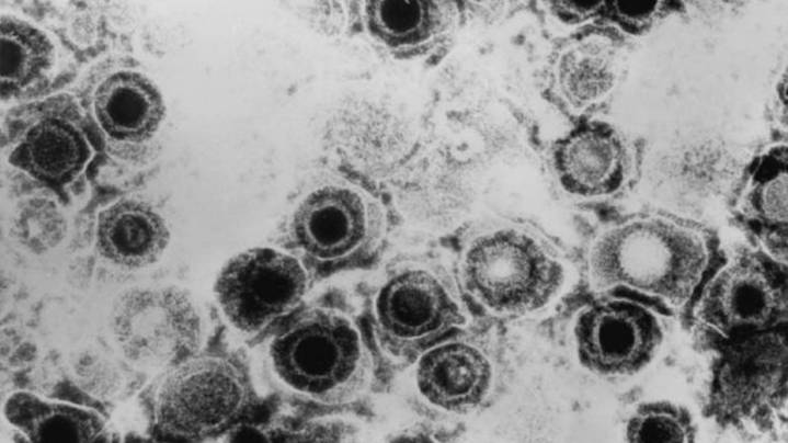 Nuevo y prometedor fármaco contra el herpes simple