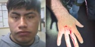 Man in U.S. illegally facing assault charges for biting ICE officer during arrest, officials say