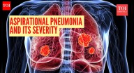 Aspiration pneumonia: Doctor explains how a 'simple accident' can lead to this life
