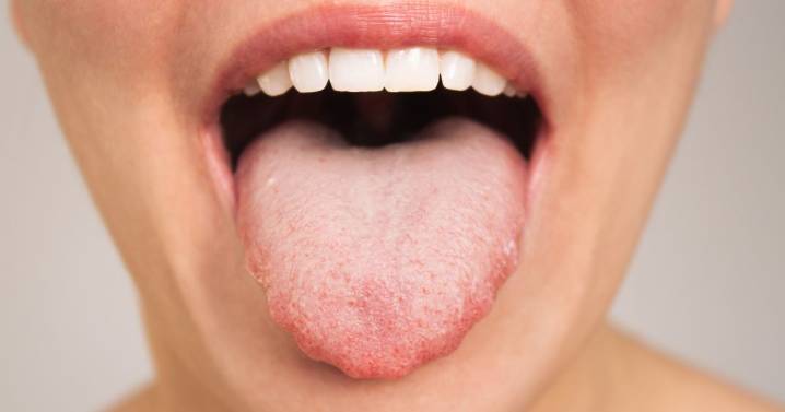What you need to know as mouth symptoms could mean a thyroid problem