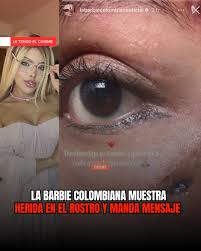 Barbie Colombiana comparte imagen con herida visible tras presunto atentado